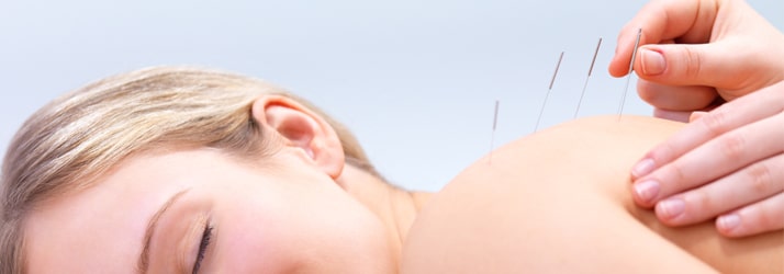 Chiropractic Elk River MN acupuncture Chiropractic Elk River MN acupuncture